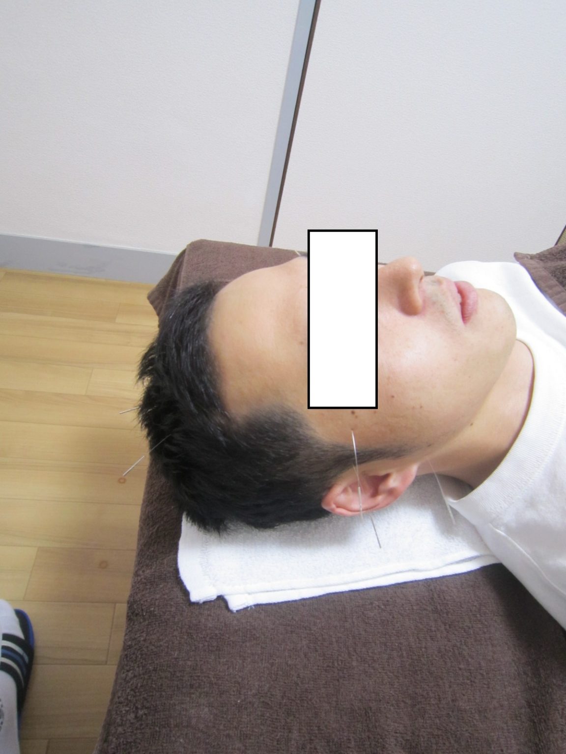 30代男性 めまい 頭痛で来院 思いもよらない原因が・・・ 神戸市垂水の鍼灸整体院｜縁鍼灸整体院